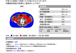 新型のＣＴ装置が導入されました！2