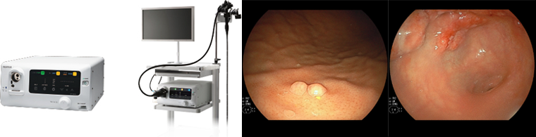 内視鏡検査（胃カメラ、大腸カメラ）